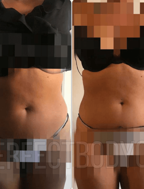 Minceur & Cellulite 2