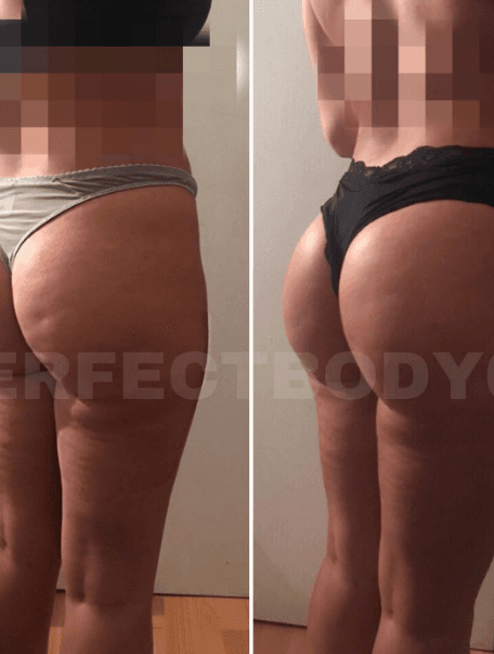 Minceur & Cellulite 3
